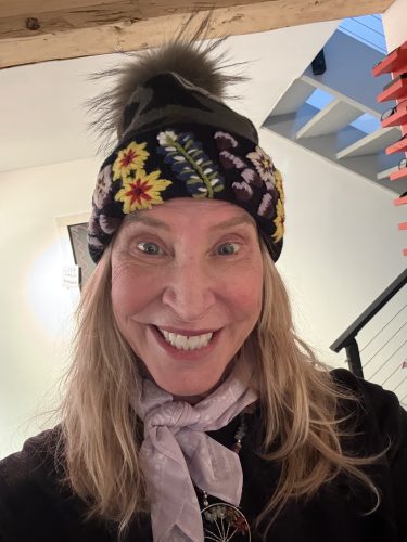 Elasty F Plus (2 syringes) photo review