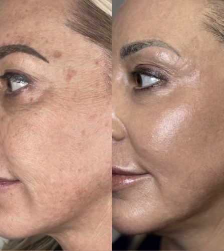 Richesse Collafilo photo review