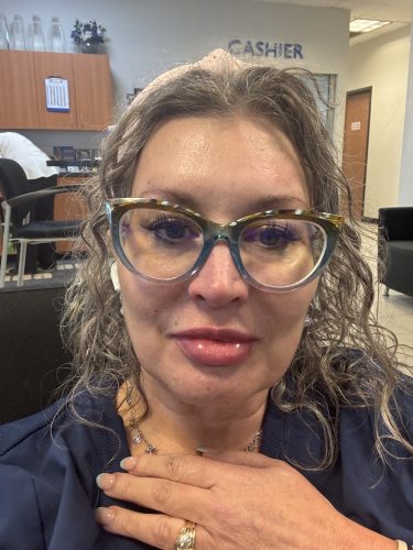 Elasty F Plus (1 syringe) photo review