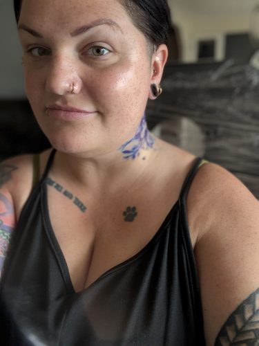 Elasty F Plus (1 syringe) photo review