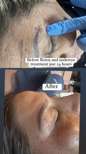 REJUVENEX Hydro Essence photo review