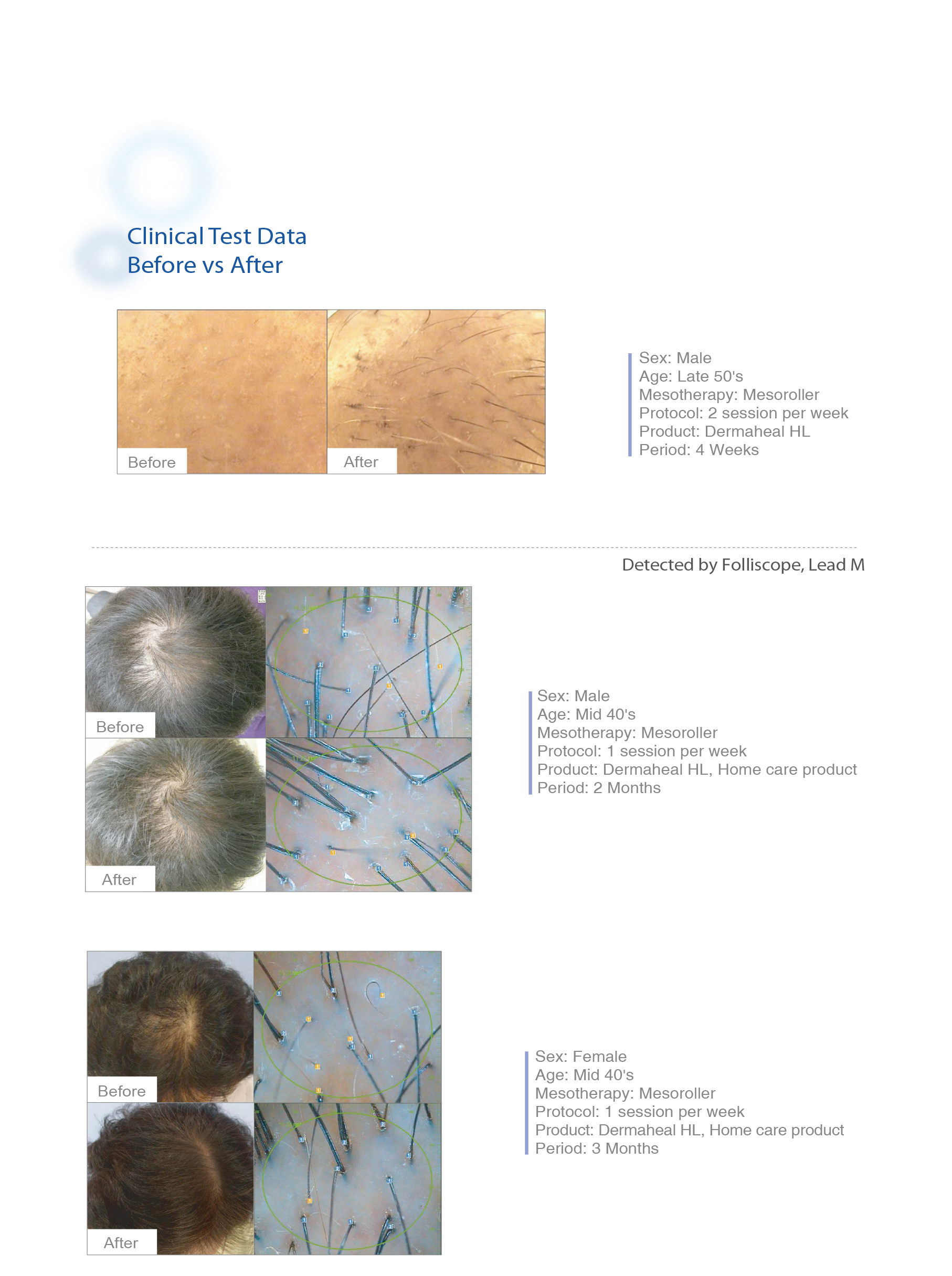 Dermaheal HL - photo 17