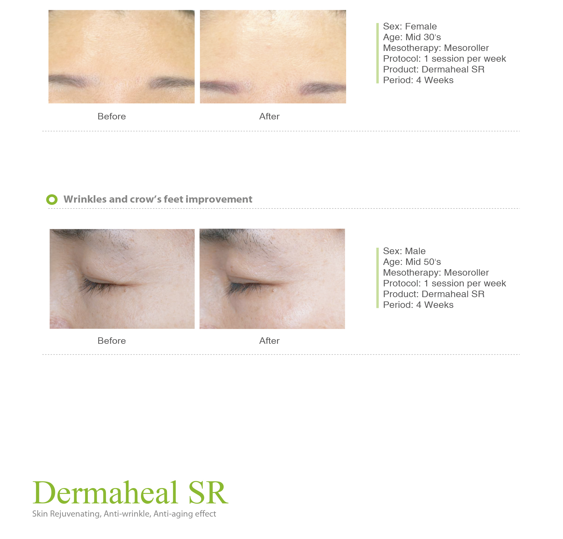Dermaheal SR - photo 20