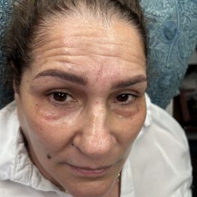 Meditoxin 200 Units; photo review