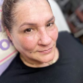 Meditoxin 200 Units; photo review