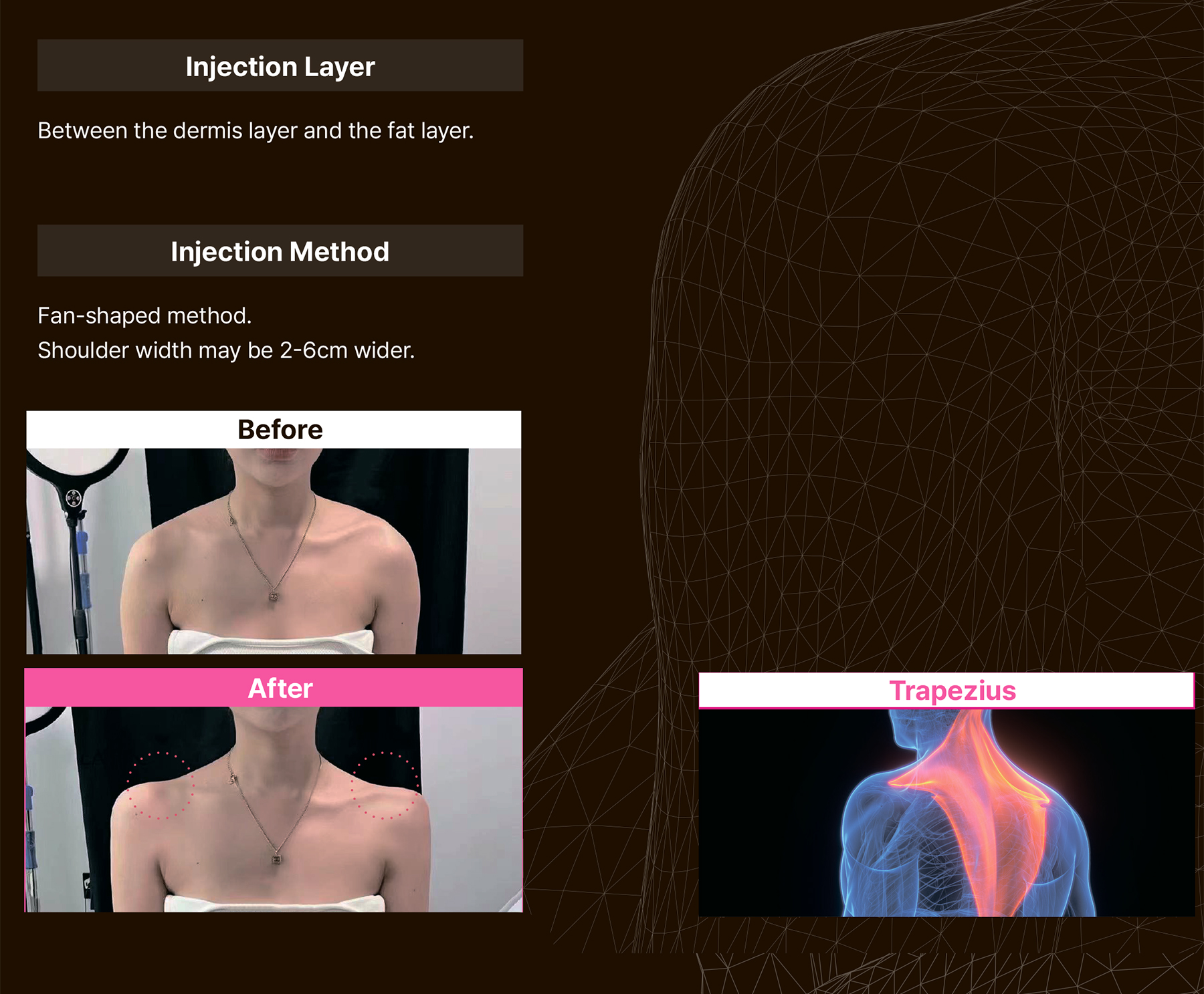 Maxy Fill Body Filler 70 ml - photo 24