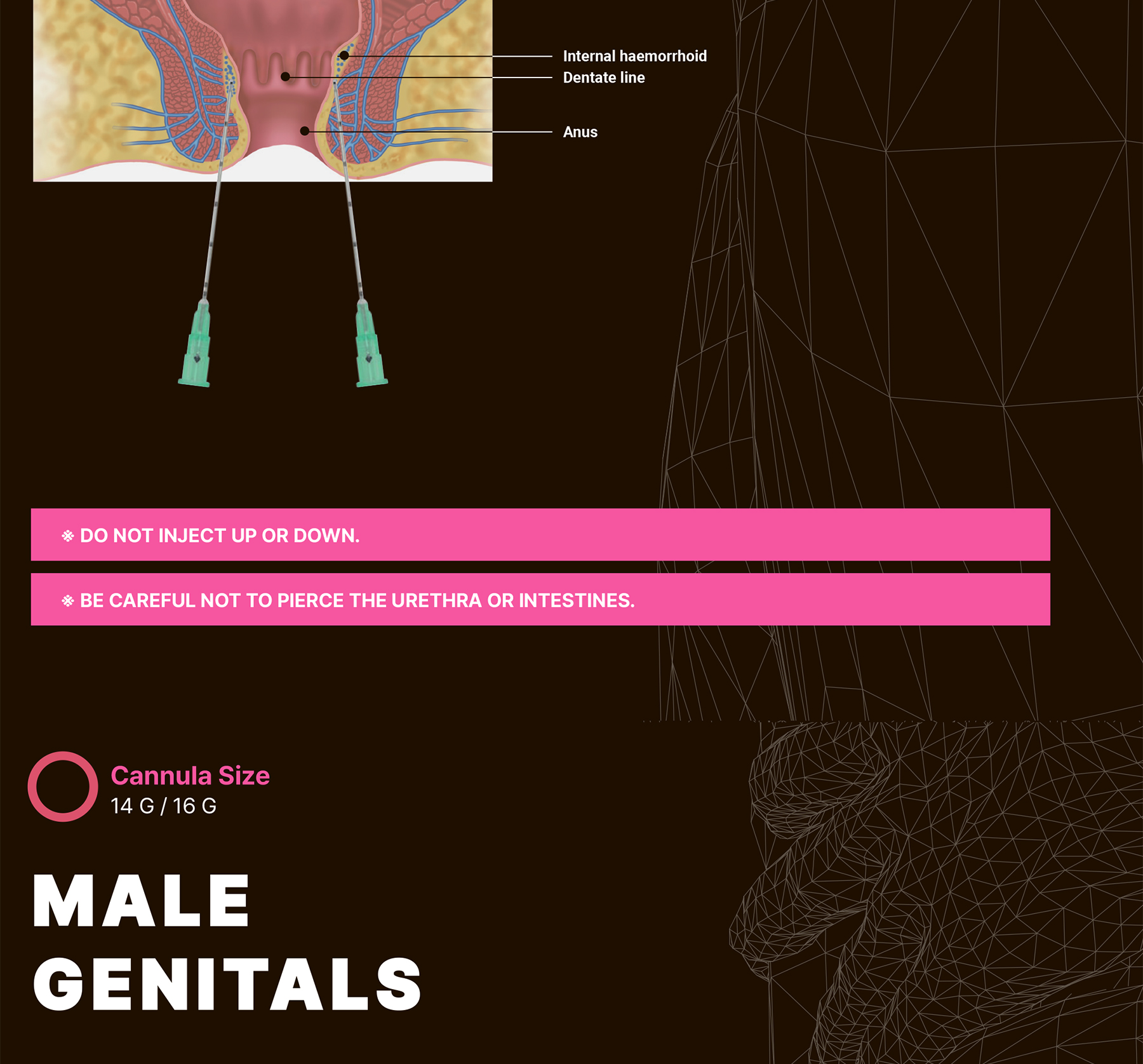 Maxy Fill Body Filler 70 ml - photo 26