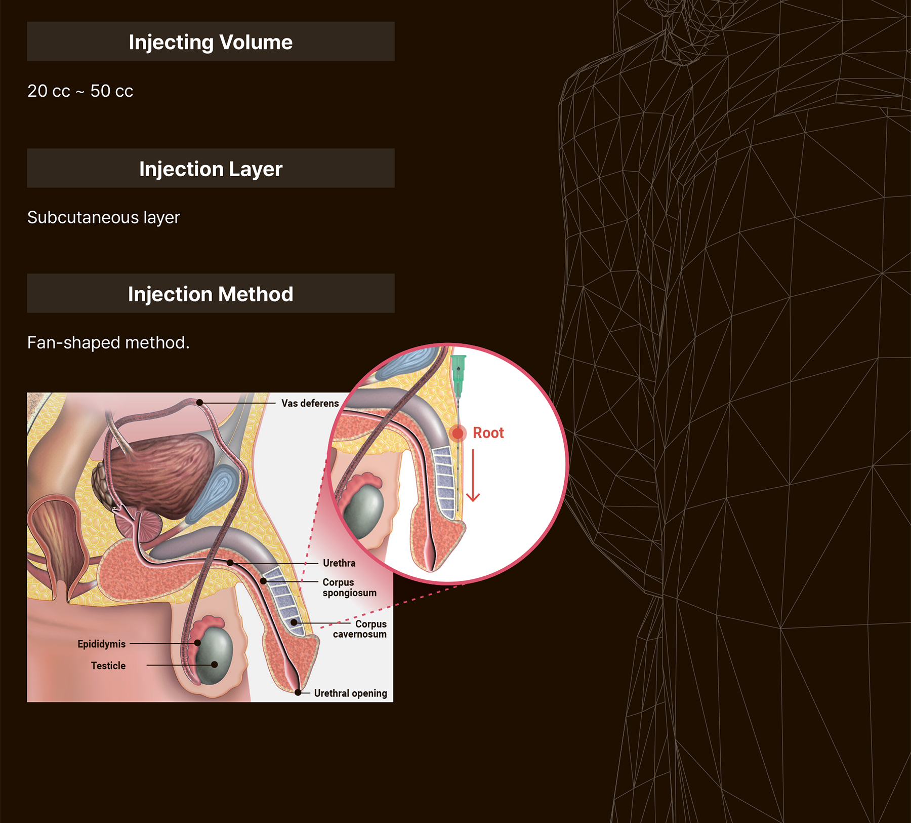 Maxy Fill Body Filler 70 ml - photo 27