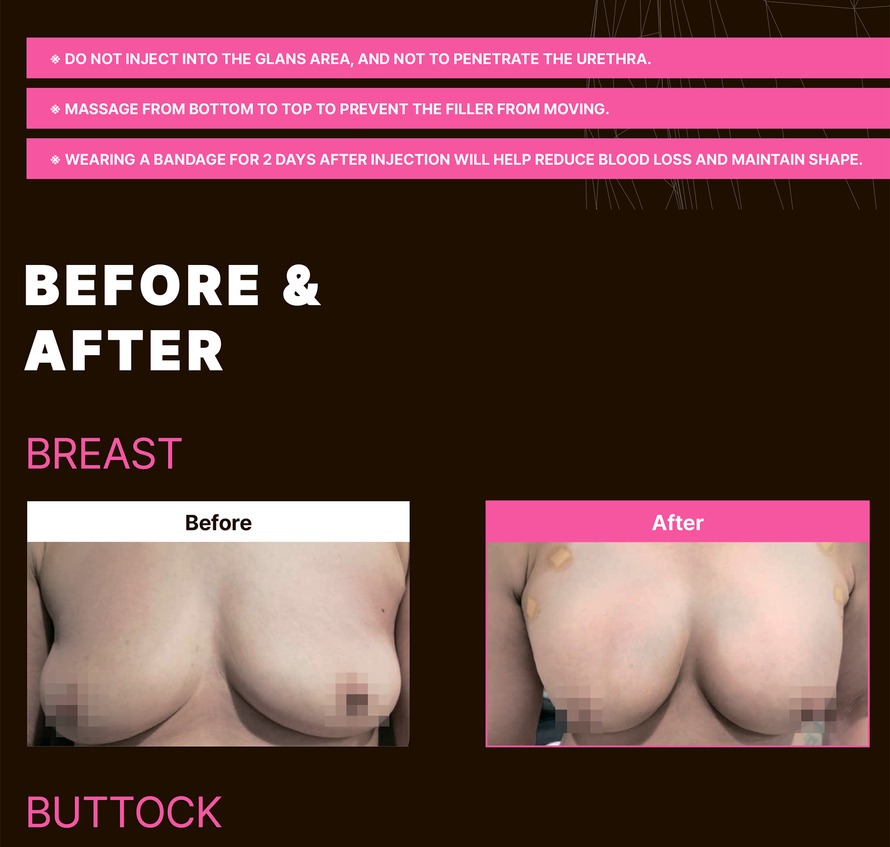 Maxy Fill Body Filler 70 ml - photo 28