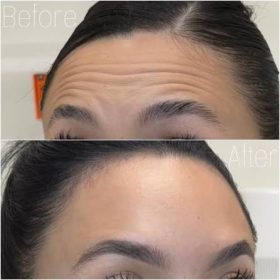 Nabota 200 Units photo review