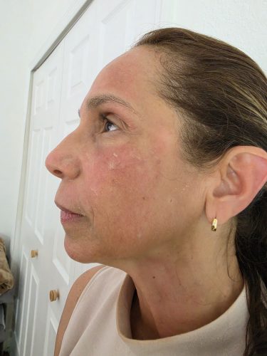 Elare PN Red Pro photo review