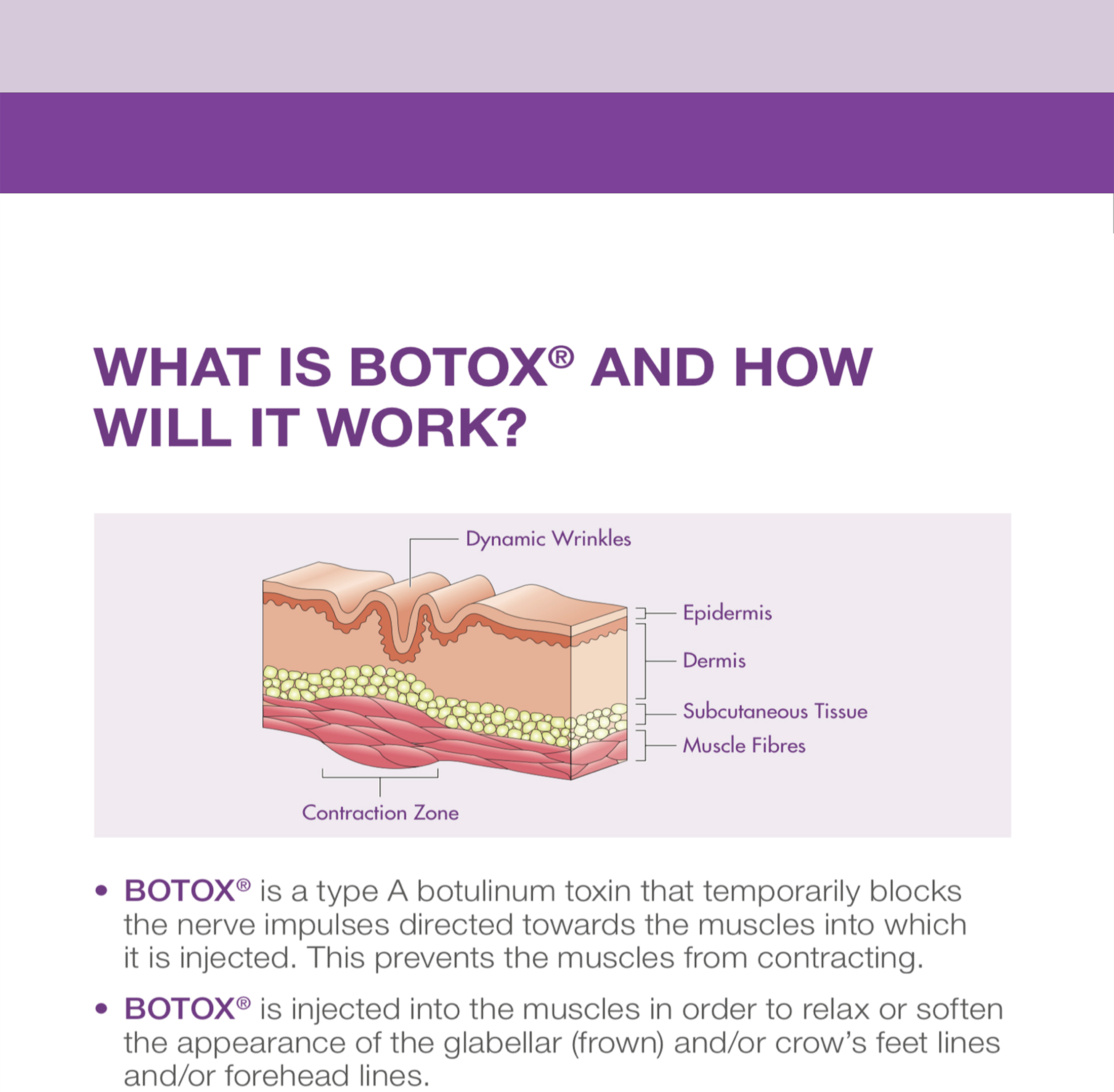Botox 50 Units - photo 12