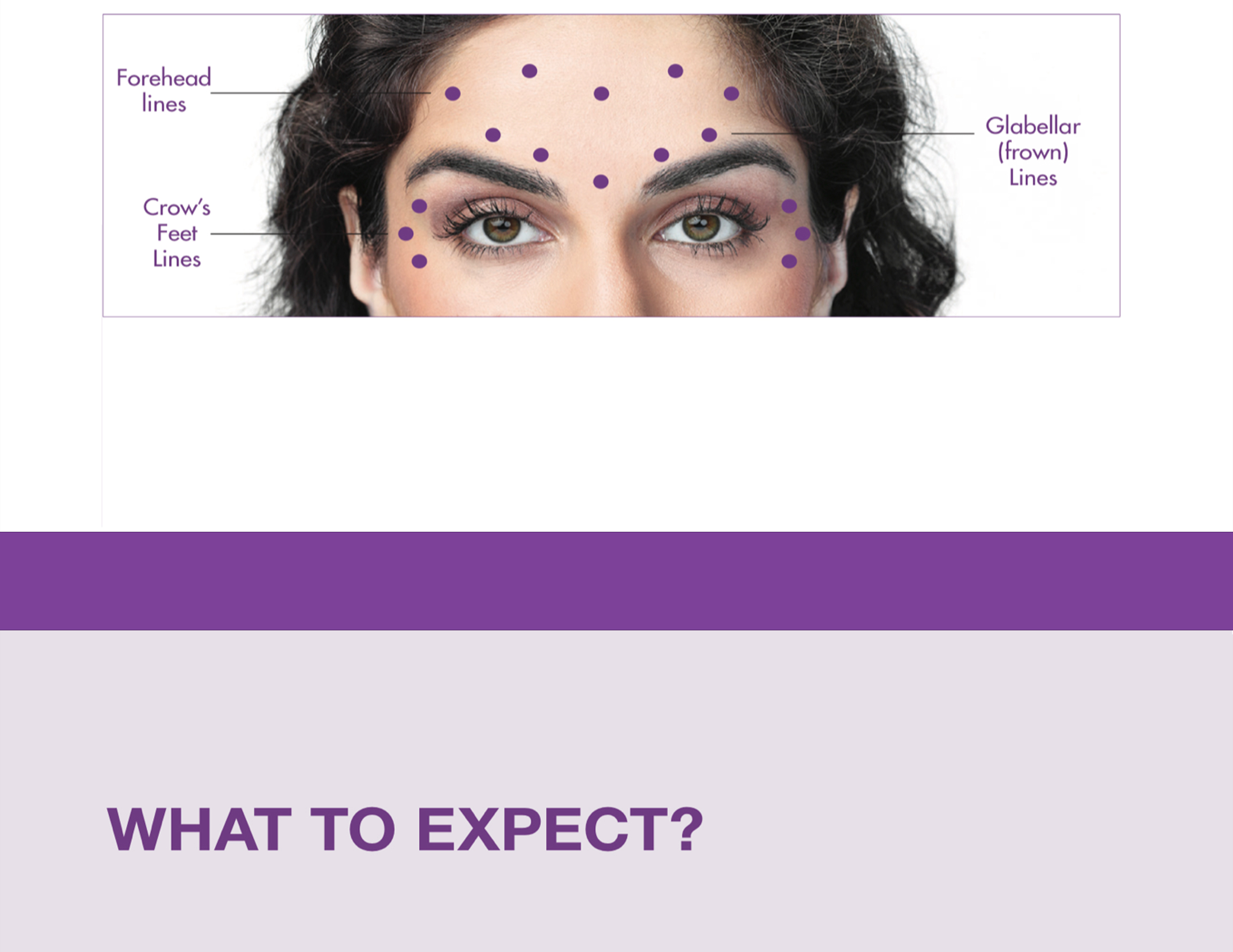 Botox 50 Units - photo 13