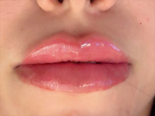 Biofiller Deep photo review